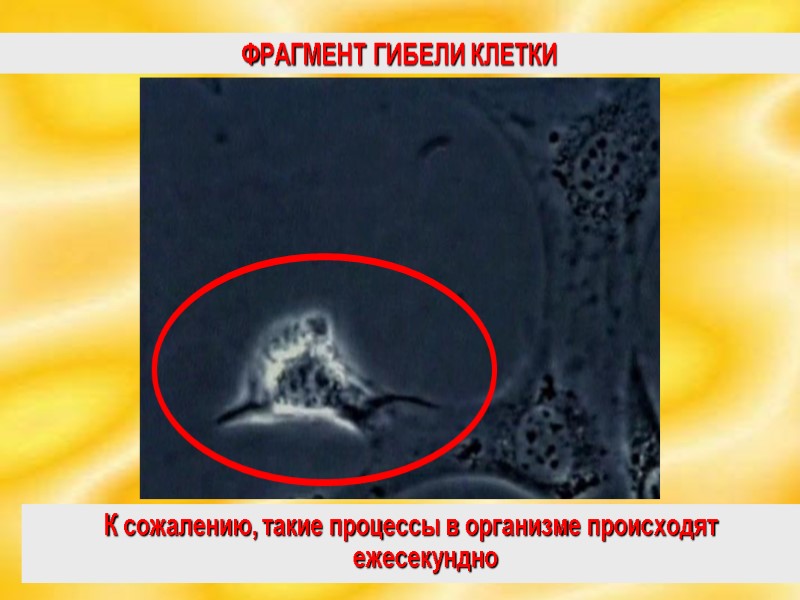 ФРАГМЕНТ ГИБЕЛИ КЛЕТКИ К сожалению, такие процессы в организме происходят ежесекундно